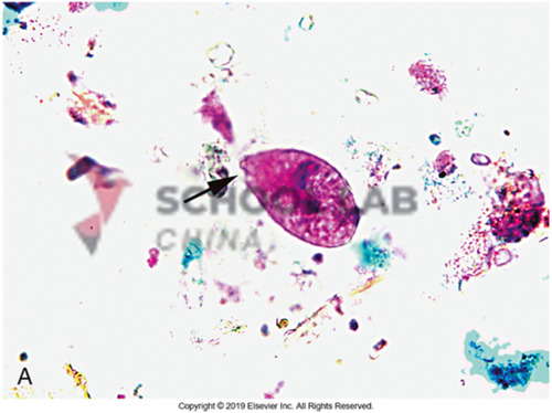 Prepared Microscope Slide - Mixed Protozoa W.M.